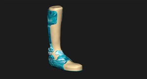 Digital Rendering of a Custom AFO Design on the Rectified Model