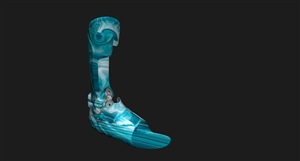 Digital Rendering of a Custom AFO design