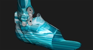 Digital Rendering of a Custom AFO design